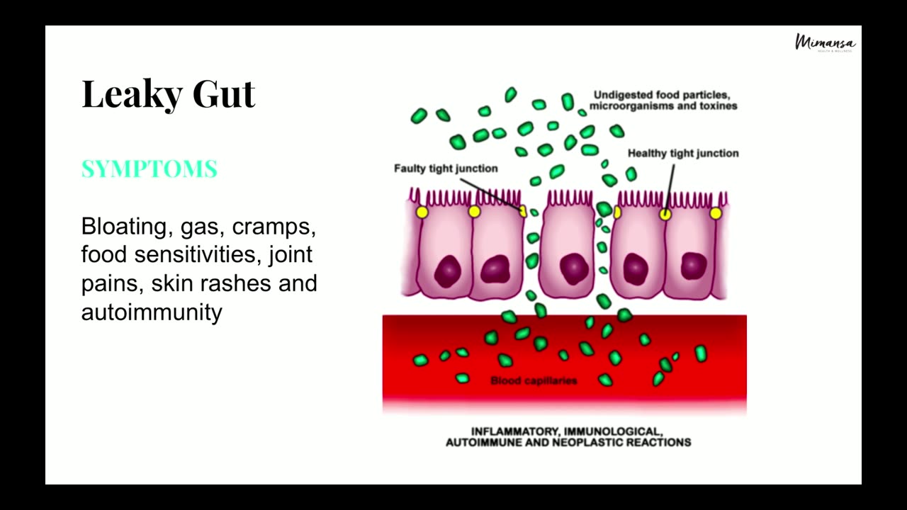 Personalized Nutrition: Optimizing Health & Longevity via Gut Microbiome - Dr Mima Geere (June 2019)
