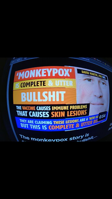 monkey pox is a cover story for the covid vaxx side effects