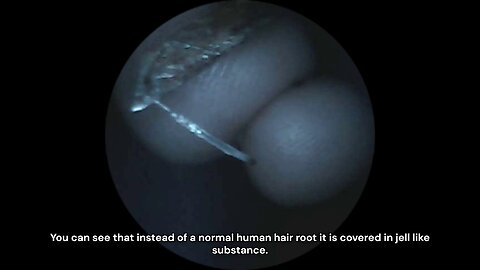 Symbiotic Parasite within Targeted Individuals?