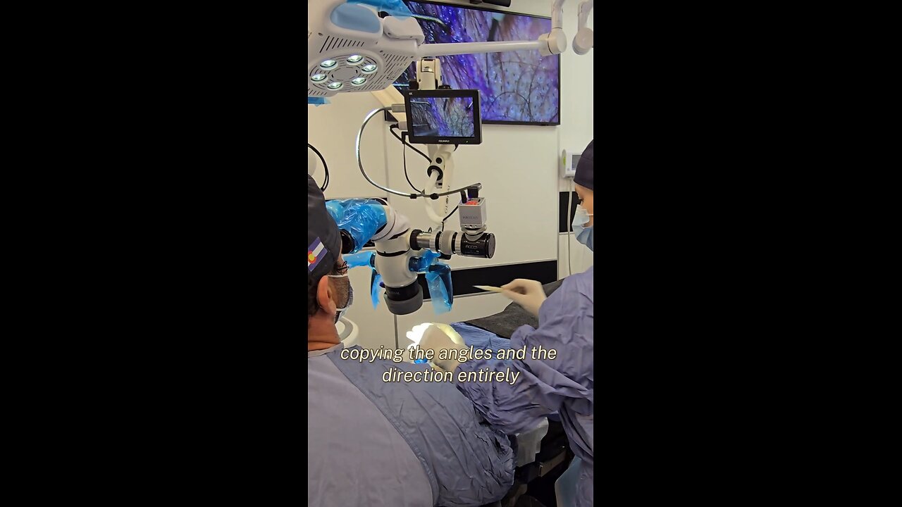 New Women FUE Procedure!