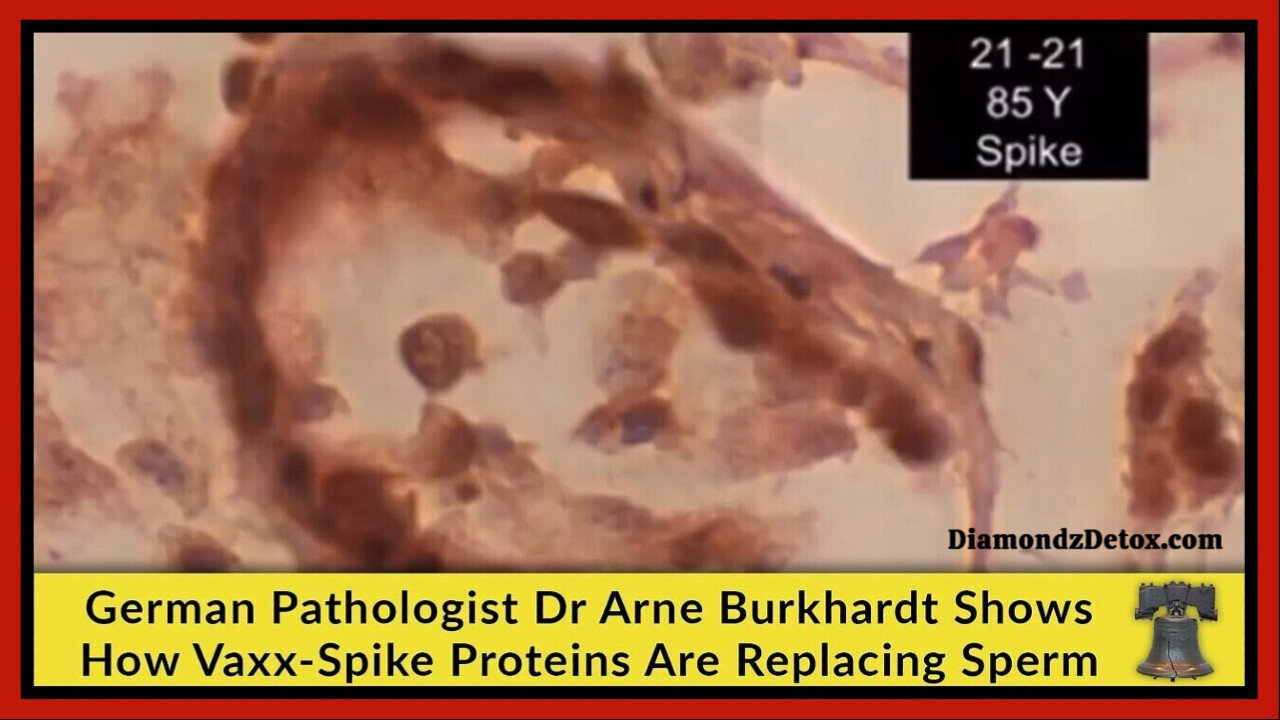 💉 German Pathologist Dr. Arne Burkhardt Shows How Vaxx-Spike Proteins Are Replacing Sperm