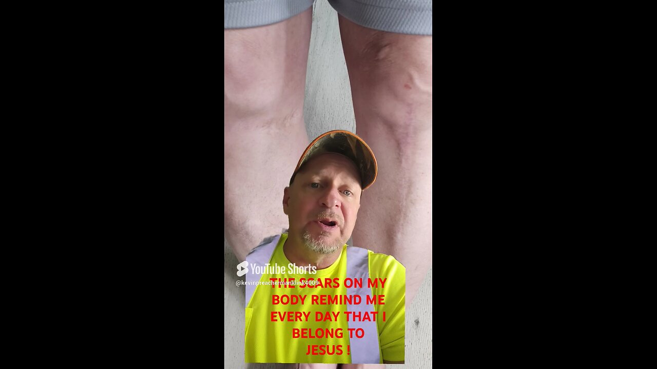 #GALATIANS6:17 "MY SCARS ARE PROOF THAT I BELONG TO JESUS !"