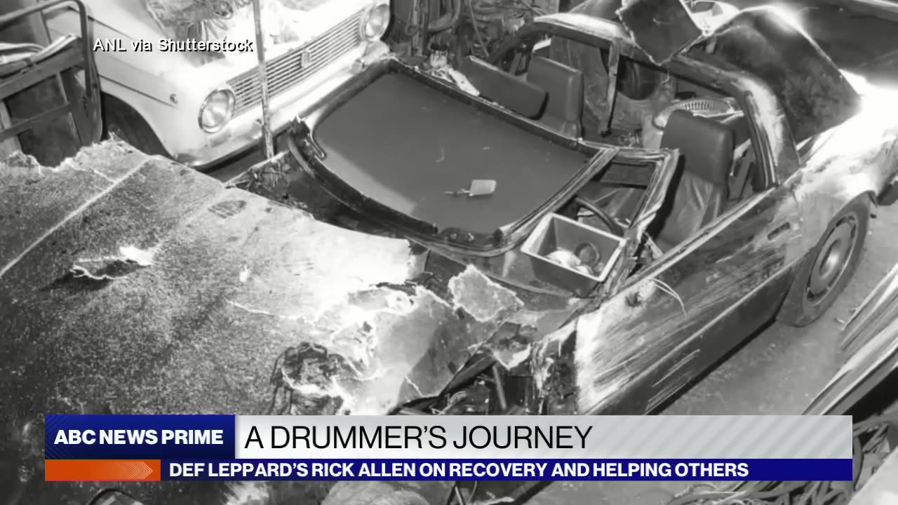 Def Leopard - Drummer's Inspiring Story