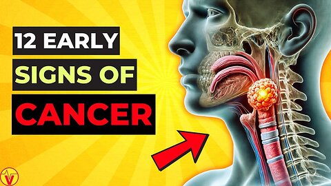 Spot These Twelve Urgent Clues Cancer Might Be Lurking in Your Body! VJ25