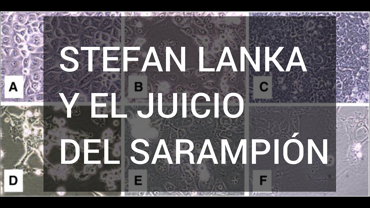 STEFAN LANKA Y EL JUCIO DEL SARAMPIÓN
