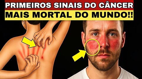 URGENTE! Este Câncer Mata 95% das Pessoas - 9 Sinais Que Seu Corpo Está Gritando