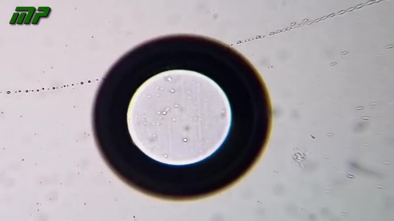 Microscope analysis of the AstraZeneca vaccine, by Dr. Liliana Zelada Rück.
