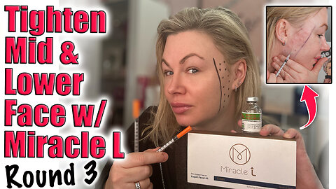 Tighten Mid & Lower Face with Miracle L, Round 3 AceCosm! Code Jessica10 Saves you Money
