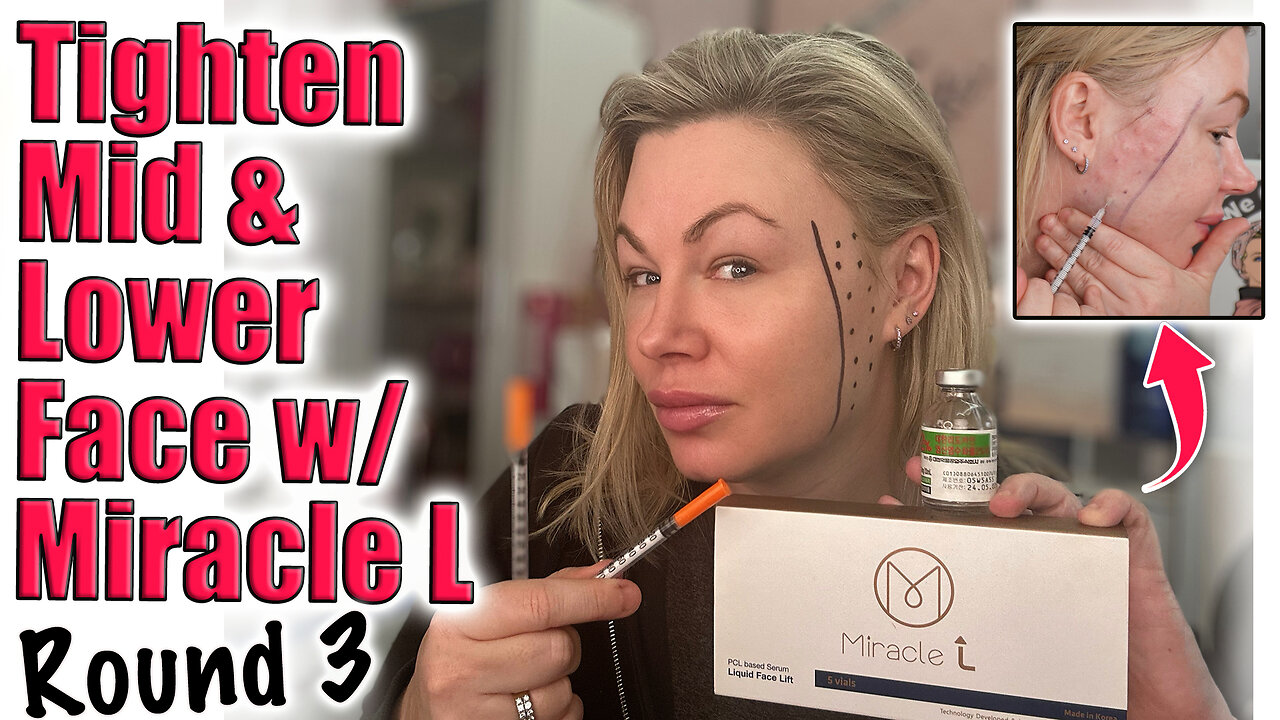 Tighten Mid & Lower Face with Miracle L, Round 3 AceCosm! Code Jessica10 Saves you Money