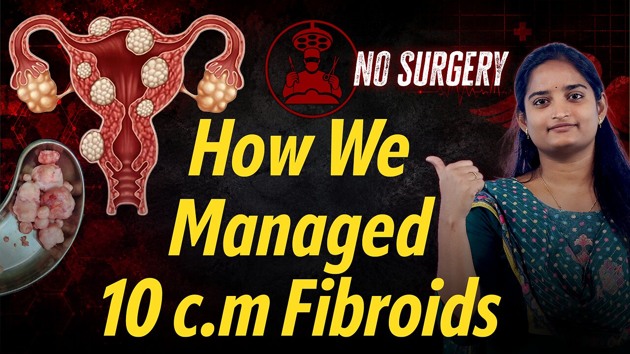 How To Cure 10 C.M Large Fibroids Without Surgery | Uterus Lumps Homeopathy Treatment Best Medicine