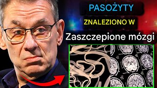 Naukowcy odkrywają „Pasożytowe istoty” w mózgach złośonego - zaciemnienia mediów