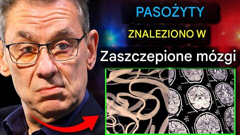 Naukowcy odkrywają „Pasożytowe istoty” w mózgach złośonego - zaciemnienia mediów