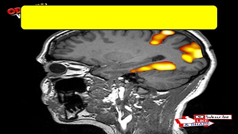 Temptation's Grip: Mind Control Secrets Revealed #SelfControl #BrainHacks