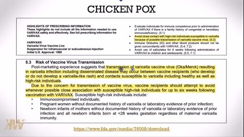 Everything you need to know from the FDA and CDC about the Chickenpox Vaccine