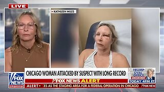 'HE PUNCHED ME IN THE FACE': Crime victim details attack by suspect with 13 prior arrests