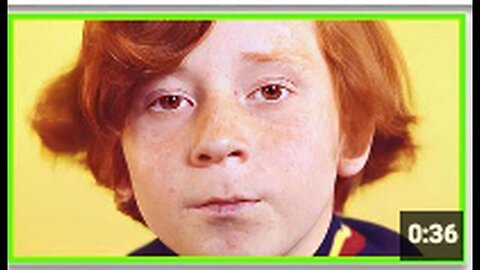 "Actor Suffers Brain Injury post-Vaccination, Requires Surgery"