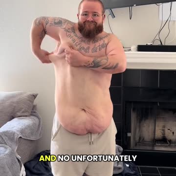 An amazing weight loss