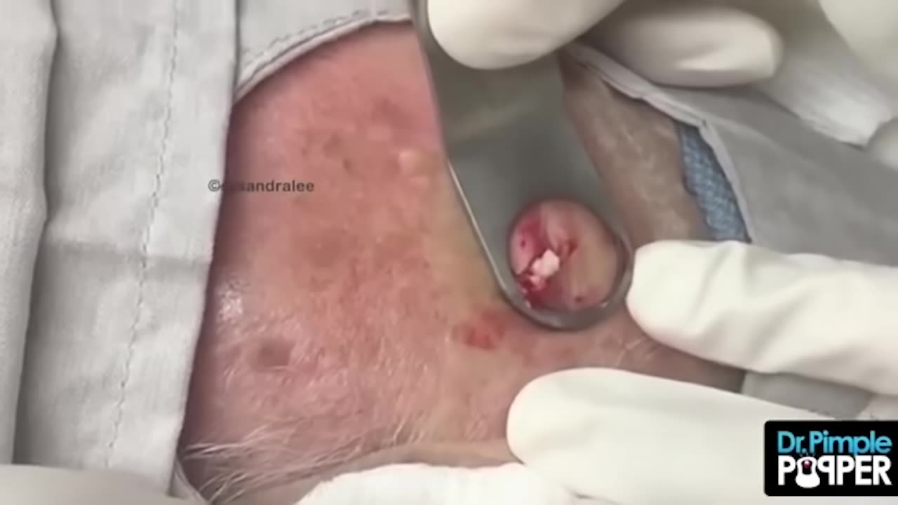 Pops That Altered My Brain Chemistry Part 2! 18 Minutes of Pops