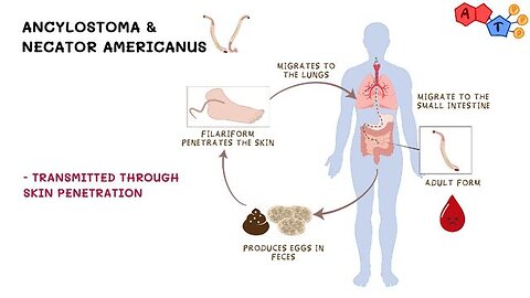 Helminths As Weapon Of Bioterrorism