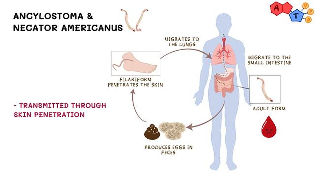 Helminths As Weapon Of Bioterrorism