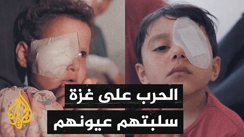 أكثر من 1500 شخص في قطاع غزة فقدوا بصرهم خلال الحرب
