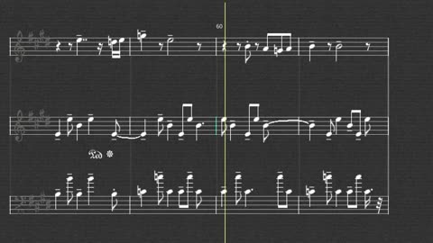 Guess Who - Undun melody, epiano and bass