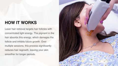Your Guide to Female Laser Hair Removal for the Face