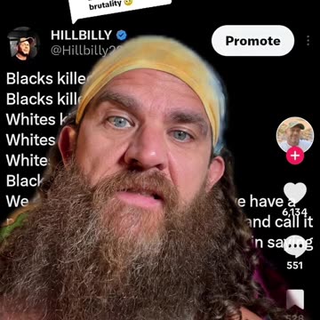 Culture #Culture #Black #White #America #TadpoleTriplett #Comedian #Comedy