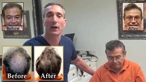 Watch This Life-Changing Corrective Hair Transplant Transformation
