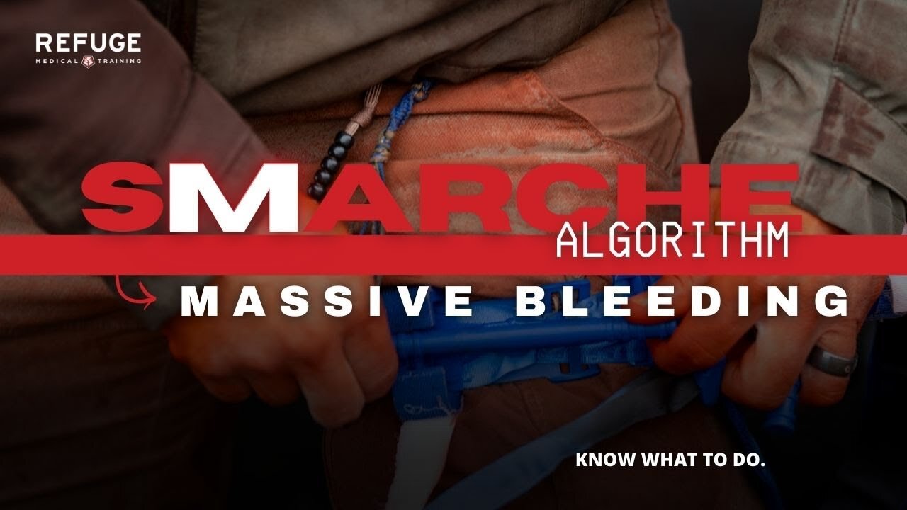 Don't Put A Tourniquet On That! | SMARCH-E | Massive Bleeding