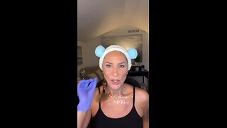 BAP Technique with Hyalace