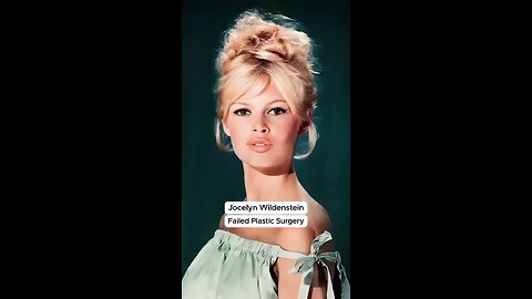 FAILED PLASTIC SURGERIES - OMG THIS IS INSANE!