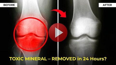 Harvard Reveals Their '5-Second Joint- Restoring Trick' Anyone Can Do at Home
