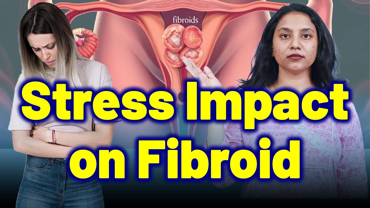Understanding the Role of Stress in Fibroid Growth. | Treatment Cure Medicine Surgery | Gynaecology