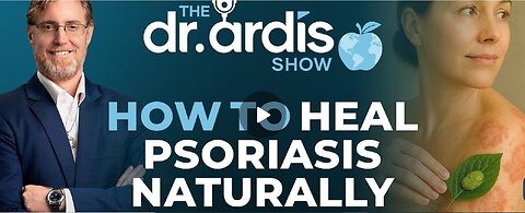 Episode 05.14.2025 - How to Heal Psoriasis Naturally - Dr. Bryan Ardis