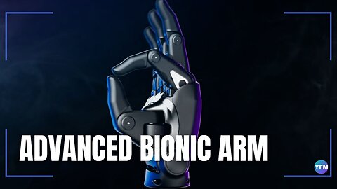Advanced bionic arm