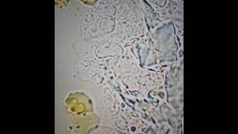 Live Blood Analysis - The Micro Robots are taking over