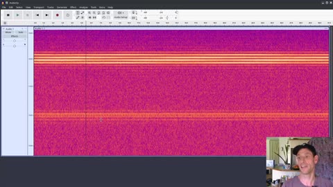 PROOF! Tinnitus is not a Medical Condition and how YOU can RECORD IT!
