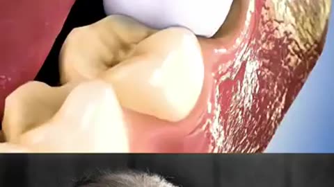 teeth replacement trending video popular 😧😔 ki Har Har Mahadev Jai premanand ki ki