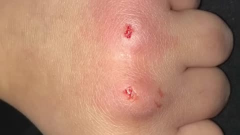 Y’all I tried the bloody knuckle game