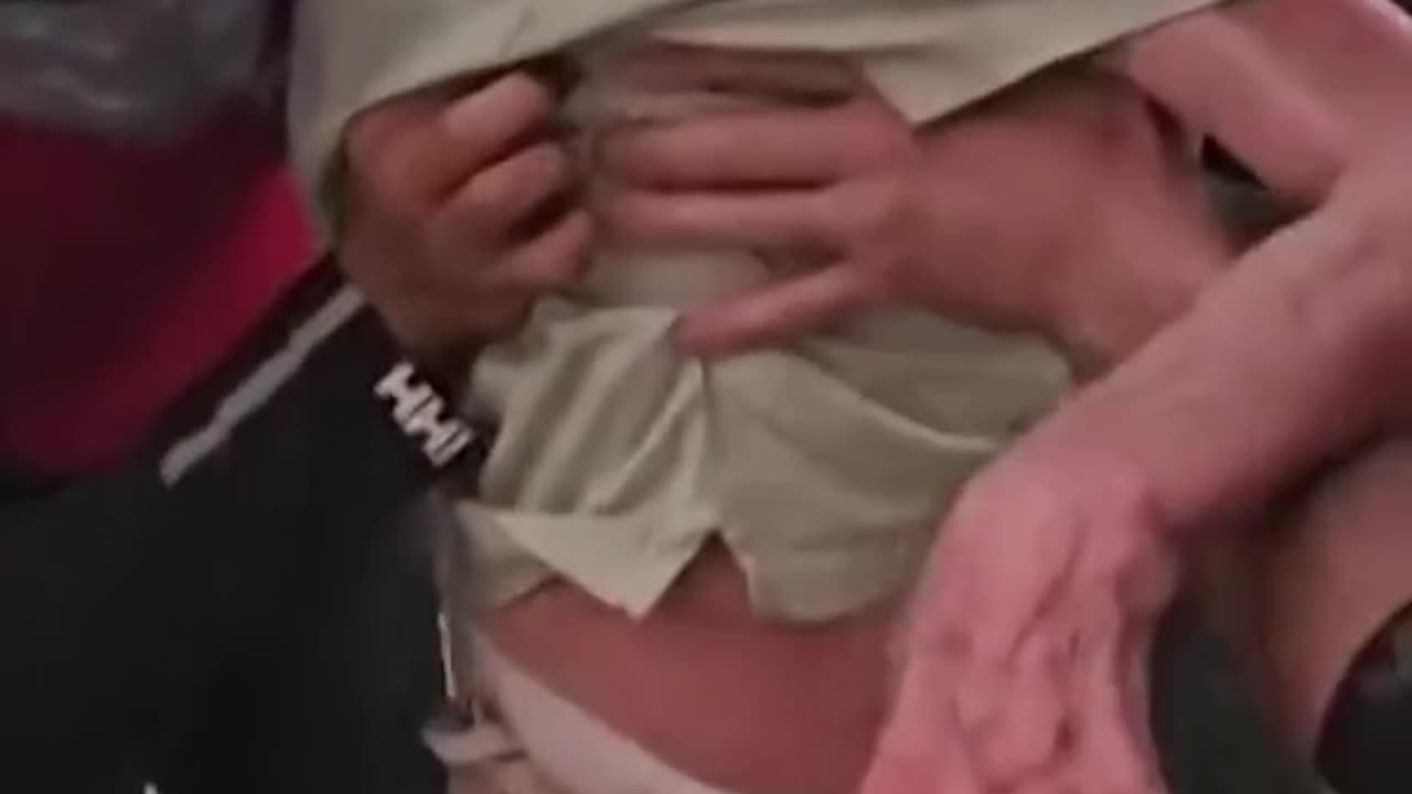 Пожилой мужчина в инвалидном кресле спасен из турецких лесных пожаров