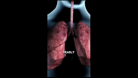 How Ciggerate Smoking Destroyes Your LUNGS 🫁!