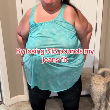 After she lost 313 pounds