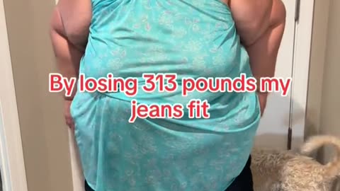 After she lost 313 pounds