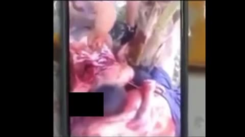 Oct 7. They cut a baby out of a mother.