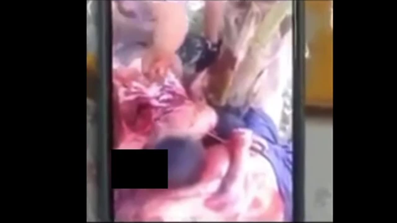 Oct 7. They cut a baby out of a mother.