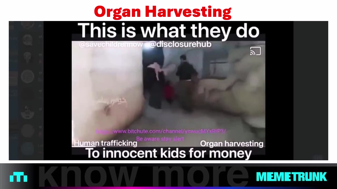 WARNING GRAPHIC ⚠️ ❗️ ORGAN HARVESTING 😭