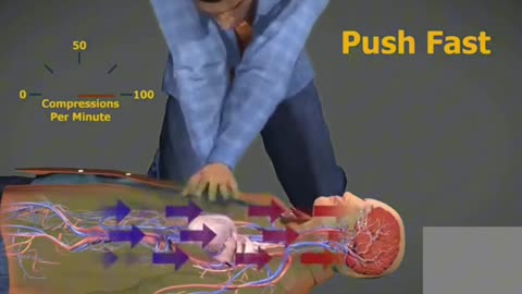Life Saving Procedure - CPR In Action 3D Animation, cardiopulmonary