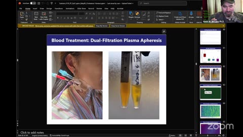 Hope for the vaccine-injured in Japan.