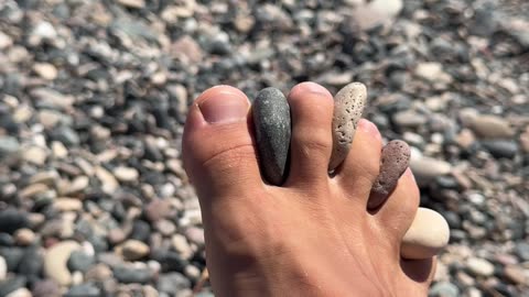 Prevence a léčba hallux valgus